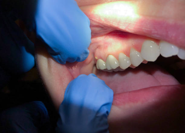 Best Urgent Care for Lost Fillings or Crowns in Lake Shore, UT